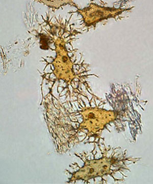 Carbon-14-dated dinosaur bones, non permineralized fossils, and soft tissue like proteins are evidence of young fossils - Page 2 Dinosaur-bone-cells