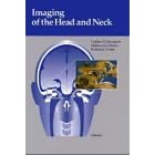 Imaging of the Head and Neck 21WN4BDPTJL._AA140_