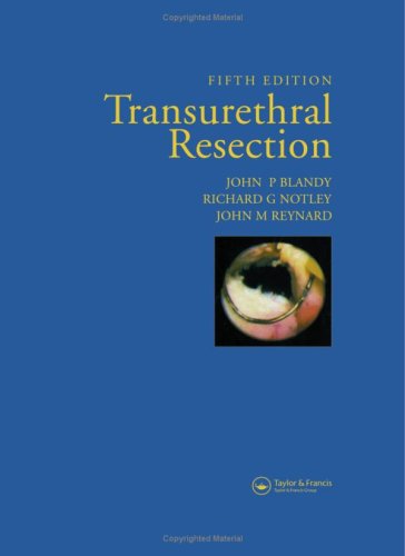 Transurethral Resection, Fifth Edition  31HeJh1GzvL