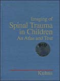 Imaging of Spinal Trauma in Children: An Atlas and Text 41-qDv6bPdL._SL160_