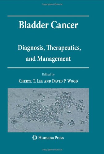 Bladder Cancer: Diagnosis, Therapeutics, and Management 417jtbd%2BdEL