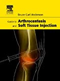 Guide to Arthrocentesis and Soft Tissue Injection 4195XVC0EZL._SL160_