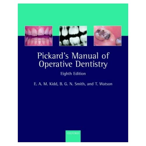 Pickard's Manual of Operative Dentistry 41Q7SEHGVGL._SS500_