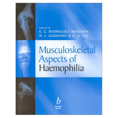 Musculoskeletal Aspects of Haemophilia 41ZQ7NK9AVL._SS500_