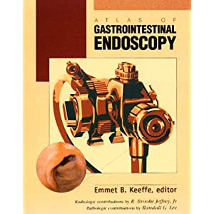 Atlas of Gastrointestinal Endoscopy 514DM9JY8VL._SL500_AA300_