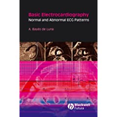 Basic Electrocardiography: Normal and Abnormal ECG Patterns 519GWuYmxWL._SL500_AA240_