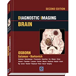 Diagnostic Imaging: Brain: Published by Amirsys 51JsYkXFrBL._SL500_AA300_