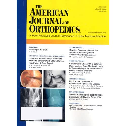 American Journal of Orthopedics 51MH9634NFL._SS500_