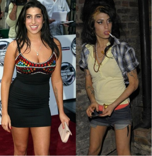 Amy Winehouse [BIOGRAFÍA] Before-and-after-amy-winehouse