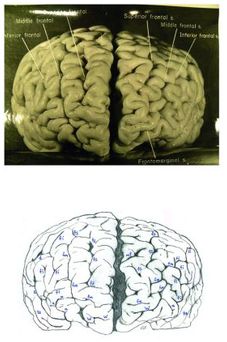  Albert Einstein: la extraña morfología cerebral de un genio Morfolog_a_cerebral