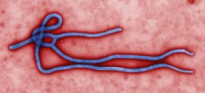 ¿Es el nuevo brote de ébola una plaga apocalíptica?#Seguimiento Ebola. Img_19482