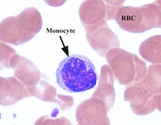 اختبار العد الكلي لمكونات الدم "CBC "Complete blood count Monocyte