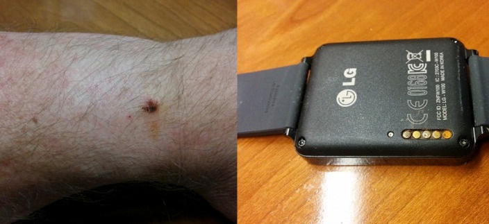 lg g watch