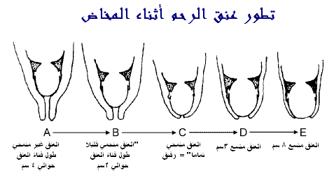 كل اسرار الولادة بالصور... Hwaml.com_1303952225_483