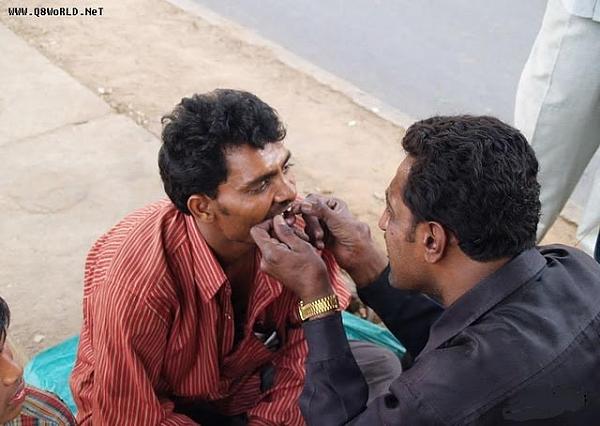 طريقة خلع الضرس وتركيبه عند طبيب الاسنان في الهند لا يفوتكم !!  Hwaml.com_1326964613_690
