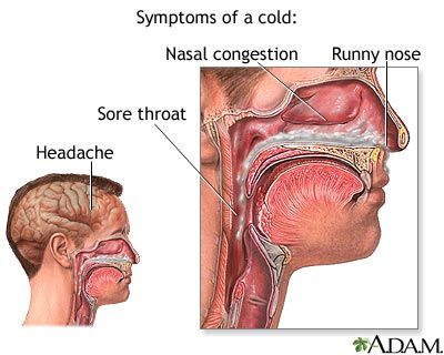 اسباب نزلة البرد ، علاج نزلة البرد    Hwaml.com_1347665018_679