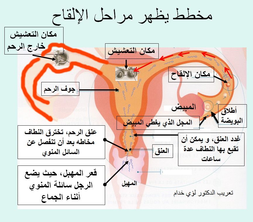 طلب توضيح من فضلكن Hwaml.com_1384851991_328