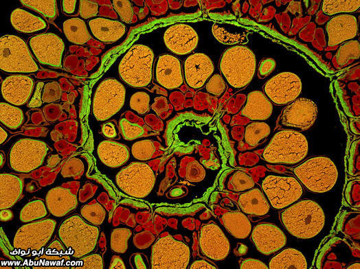 بدائع الصور العلمية لعام 2009 Anglerfish-Ovary