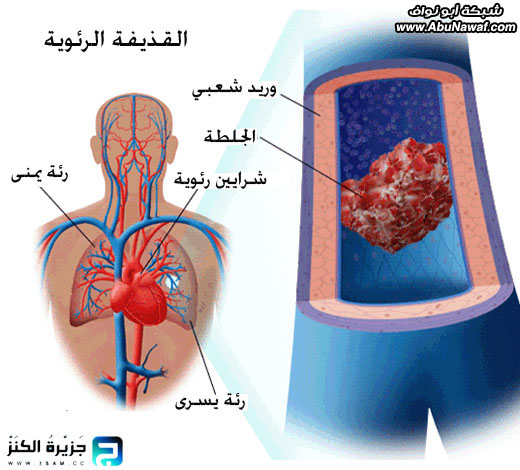 كثيراً ما نسمع عن قذائف صاروخية تنطلق عبر السماء Abonwaf2