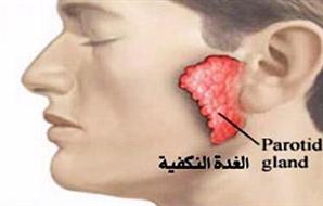 إغلاق مدرسة بالقليوبية بعد اكتشاف 6 حالات إصابة بالغدة النكافية 2012-634853052660008134-0_main_thumb300x190