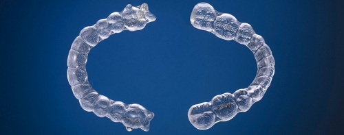 Nắn chỉnh hàm răng với invisalign Nan-chinh-ham-rang-voi-invisalign2