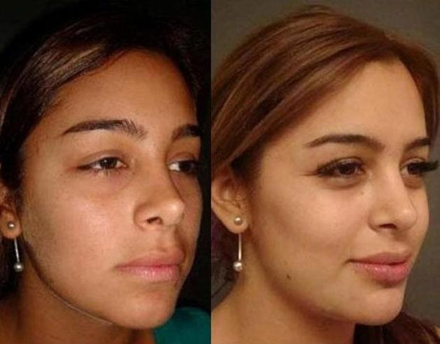 Larissa Riquelme: Antes e depois Larissa031