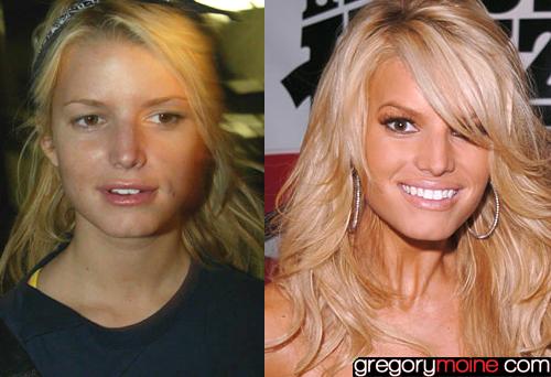 Vedettes sans maquillage Jessica-simpson