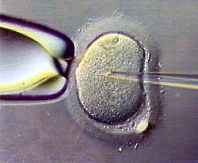 La fécondation in vitro _yartibebeeprouvette51-74898