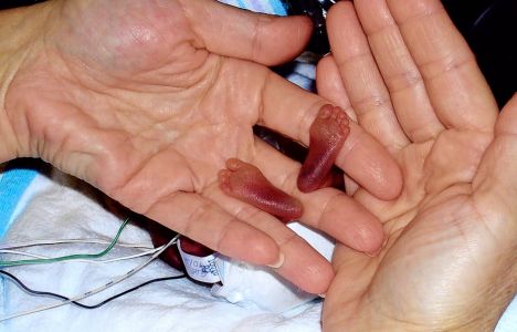 Newborn baby 'thrown out with the trash ALIVE after botched abortion' Article-1021034-0155BAC900000578-528_468x300