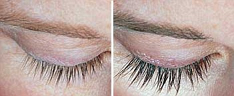 New drug allows women to grow longer and thicker eyelashes Article-1117162-03109071000005DC-547_468x193