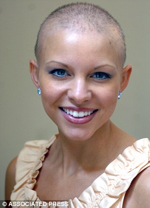 Vittima di alopecia: sarà la nuova miss America? Article-1346025-0CB7D6CD000005DC-132_306x423