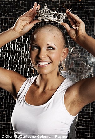 Vittima di alopecia: sarà la nuova miss America? Article-1346025-0CB93D2C000005DC-887_306x450