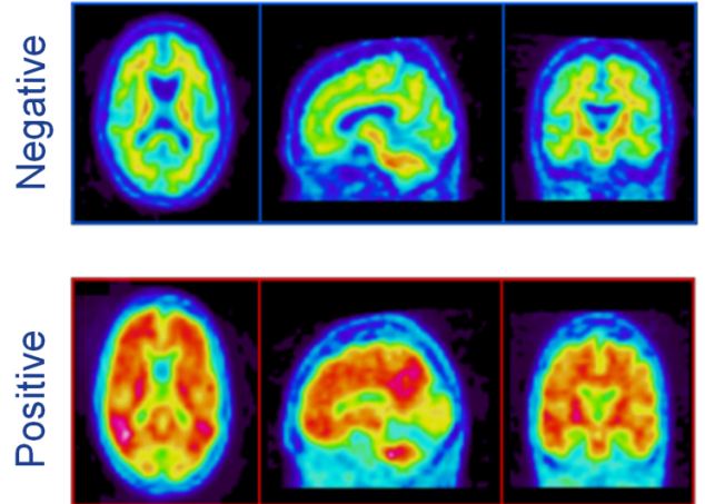 The dreams that can be an early sign of dementia Article-2297413-0EBC34E200000578-406_634x453