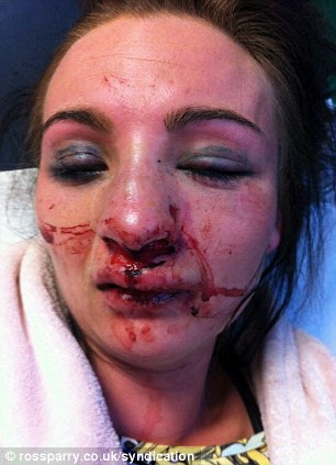 Battered by boyfriend... then denied treatment on the NHS Article-2317068-198DABF8000005DC-4_306x423