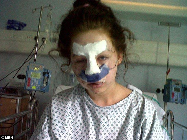 Teenager describes moment she was attacked by a dog that left her with horrific facial injuries Article-2317259-198E94C8000005DC-387_634x474