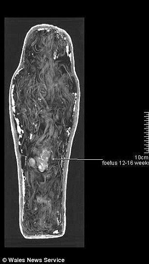 The mummified FOETUS: Scans reveal tiny ancient Egyptian sar Article-2624136-1DB19BBA00000578-417_306x542