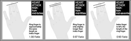 Finger length ratio and heart health Handheart221001_450x141