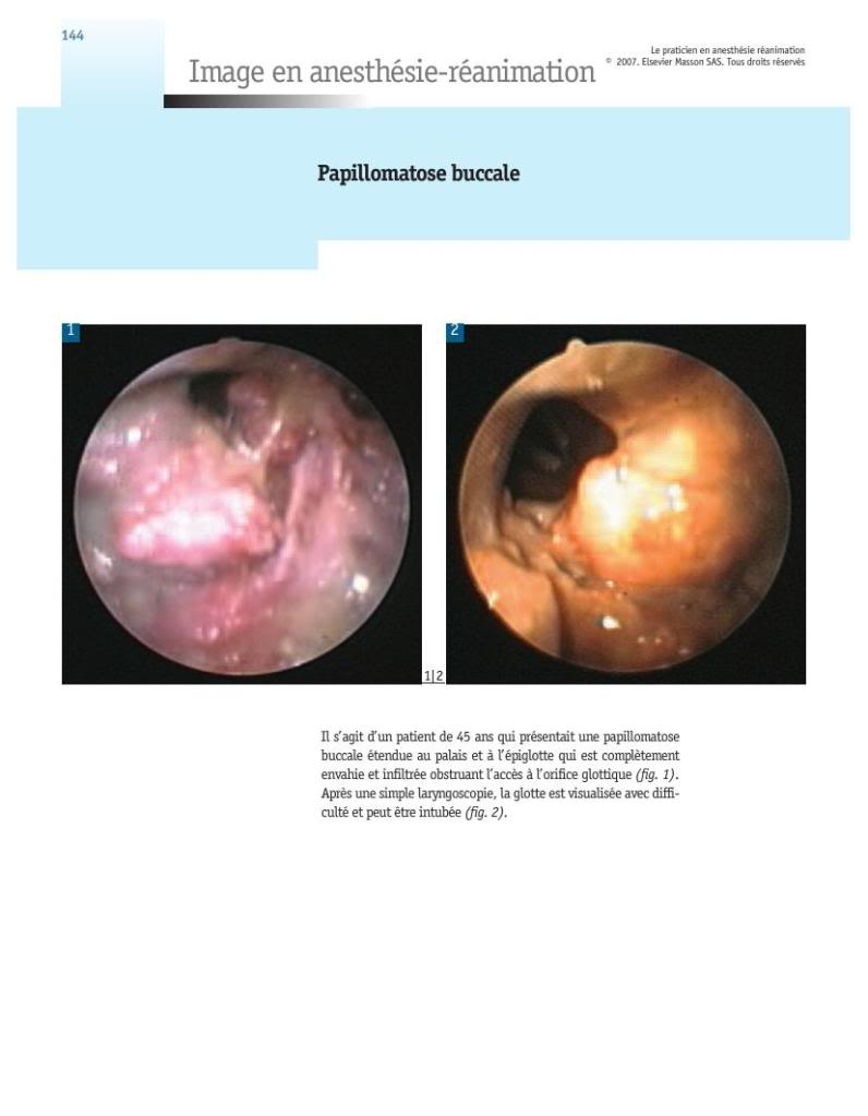 Le Maillon Faible - Stomatologie 3 LeMaillonFaible-Stomatologie0065