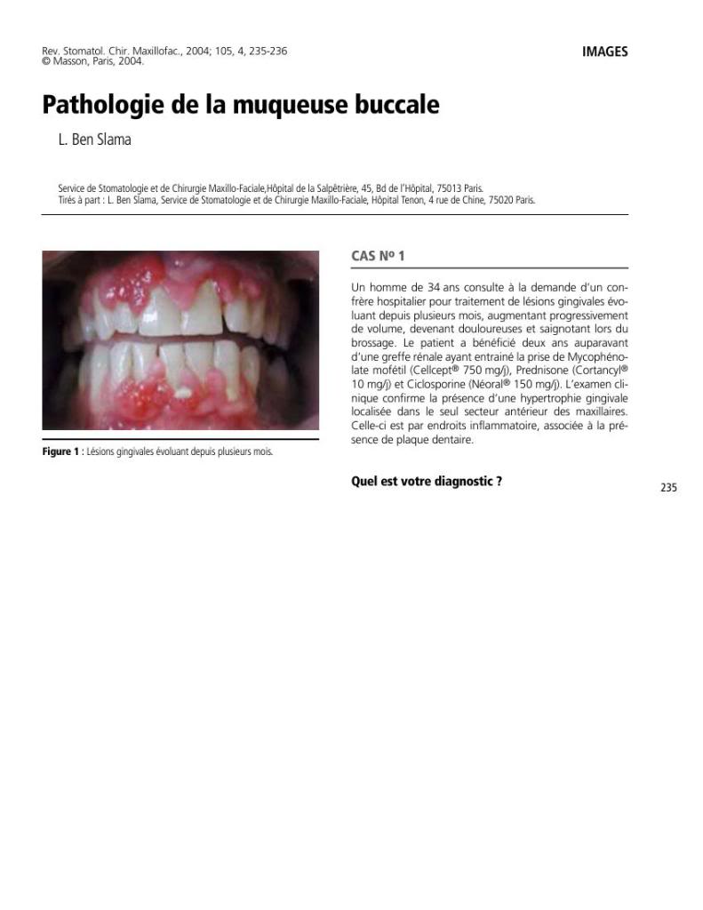 Le Maillon Faible - Stomatologie 3 LeMaillonFaible-Stomatologie0066