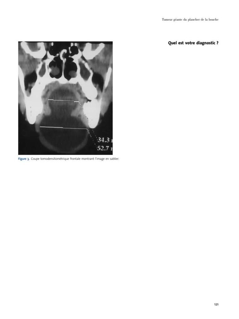 Le Maillon Faible - Stomatologie 3 LeMaillonFaible-Stomatologie0073