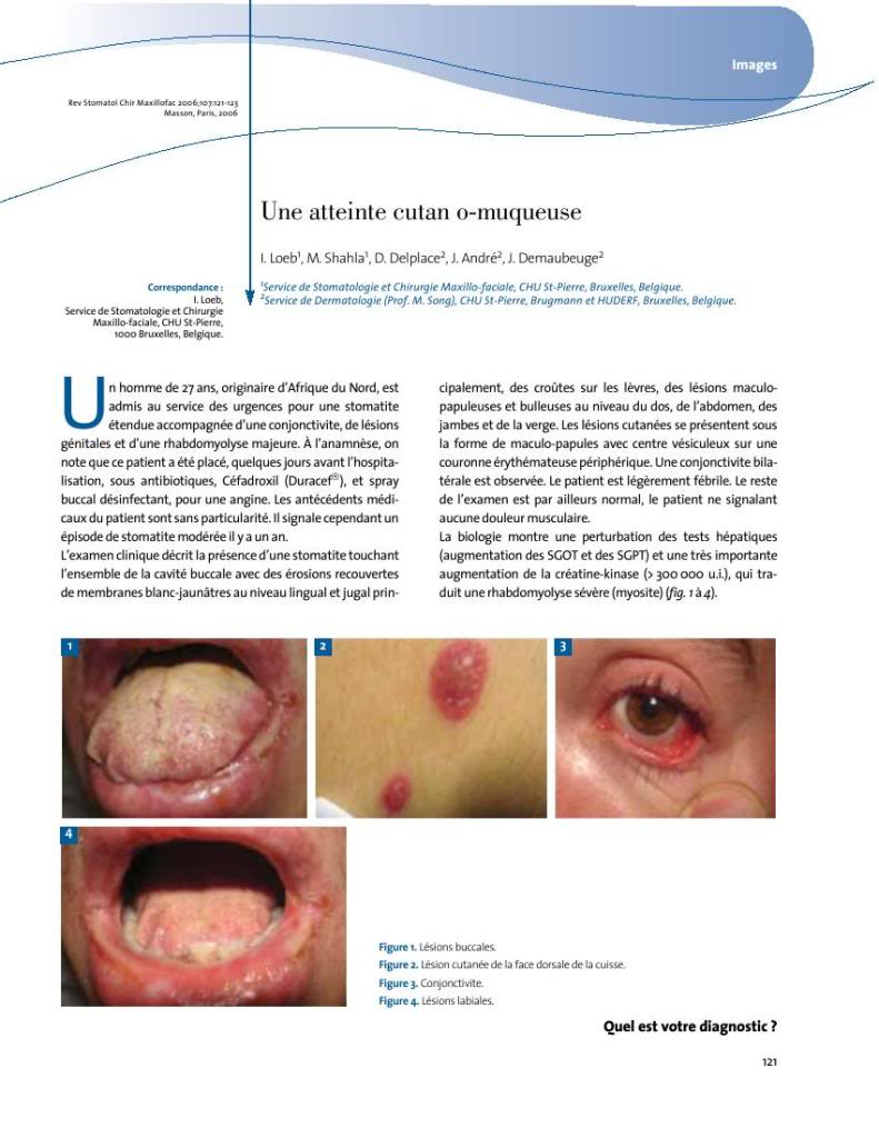 موسوعات وكتب وابحاث طبية LeMaillonFaible-Stomatologie0077