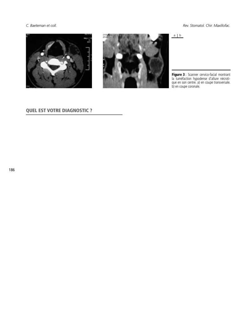 Le Maillon Faible - Stomatologie 4 LeMaillonFaible-Stomatologie0087