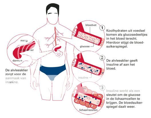 Diabetes en fibromyalgie Wat-is-diabetes