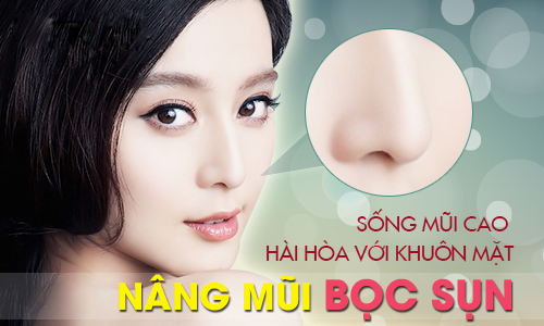 Bí quyết sửa mũi đẹp sau khi bị tai nạn Nang-mui-boc-sun-han-quoc_zps3imue6wx