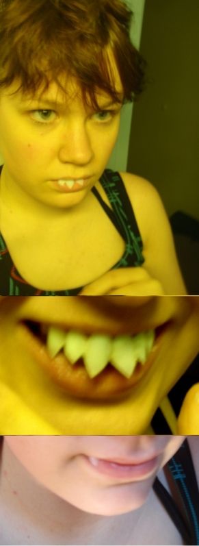 Käsipuurtaminen Teeth___wip_by_royalcoester-d3hlacj