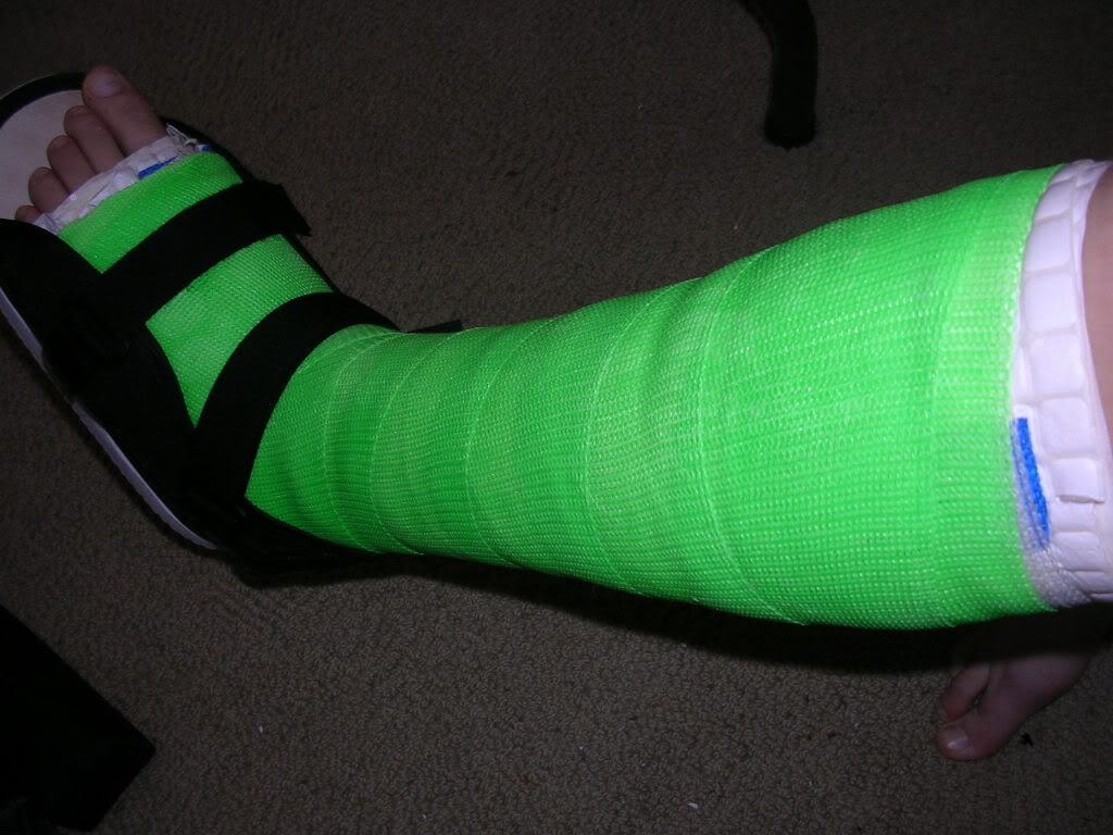 I broke my leg!!!! Come sign my cast! - Page 2 Leg087