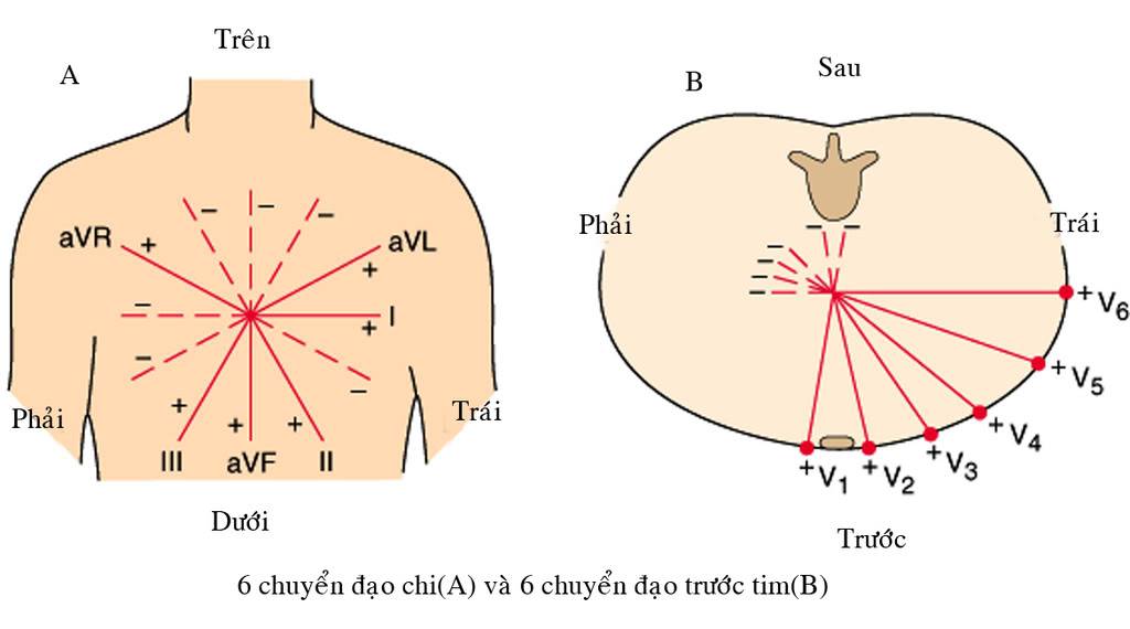 ĐIỆN TÂM ĐỒ – Chủ đề 3: RL dẫn truyền trong thất 6