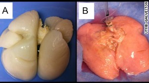 Human lung made in lab for first time  140214150321-lung-comparison-story-body