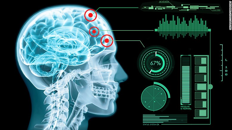 Computers will overtake us when they learn to love, says futurist Ray Kurzweil 160308131221-brain-chips-780x439