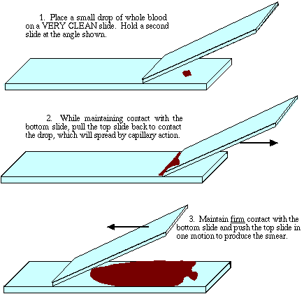 العد الكلي لخلايا الدم البيضاء Smear